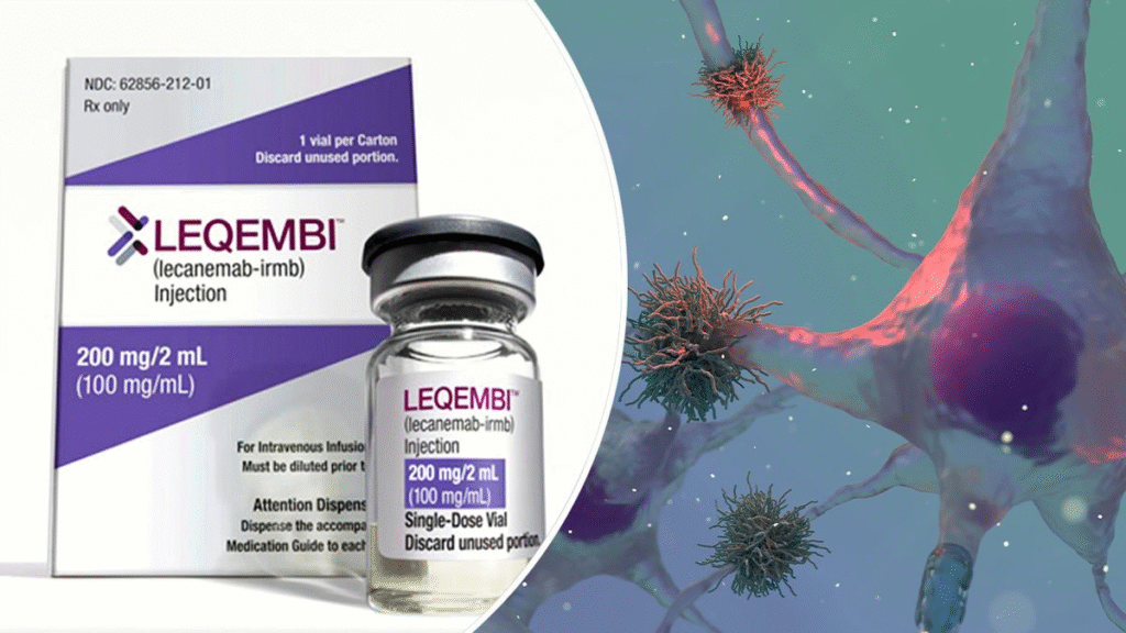 Alzheimer’s Disease 